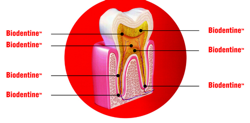 Biodentine – заменитель дентина нового поколения